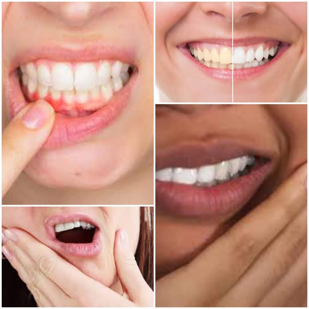 Natural teeth powder will help get rid of yellow enamel on your teeth, whiter teeth, fresher breathe, prevents cavities and strengthens gums. Multiple benefits